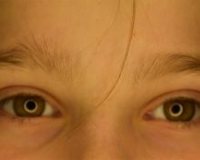 Augen